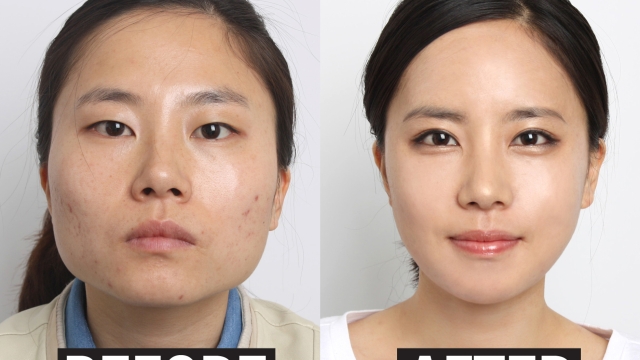 From Flaws to Fab: Unleashing the Power of a Cosmetic Surgeon