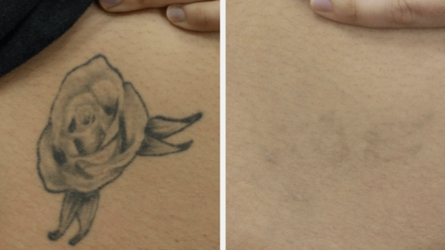 Design Your Individual Tattoo – 2 Simple And 3 Killer Tips