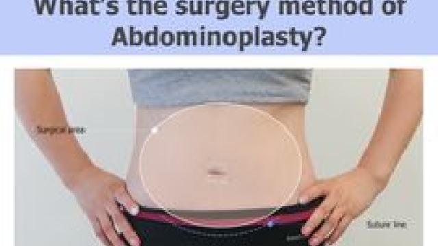 Flat and Fabulous: Unveiling the Benefits of Abdominoplasty