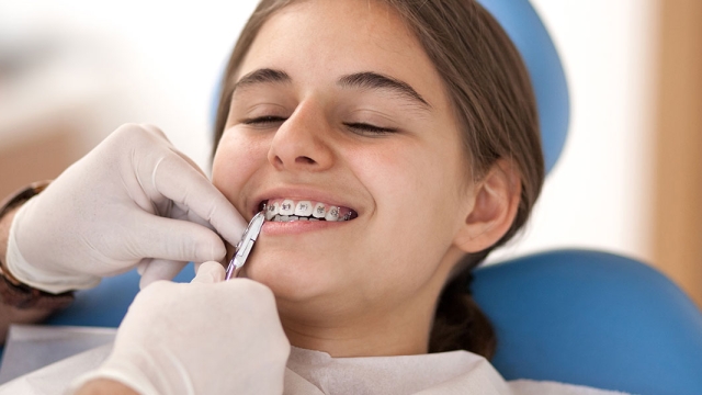 Choosing Between an Orthodontist and a Private Dentist