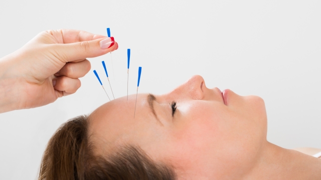 The Art of Needle Healing: Unveiling the Power of Acupuncture