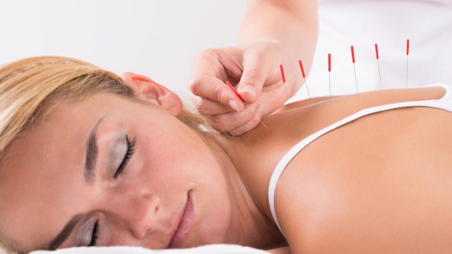 Pinpoints of Relief: Unlocking the Healing Power of Acupuncture