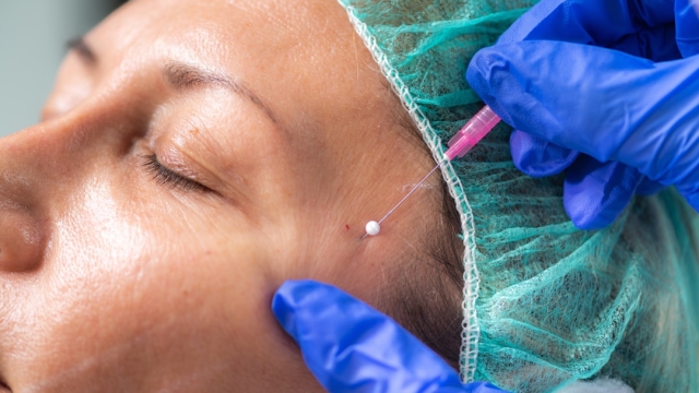 Was ist HydraFacial und wie funktioniert es